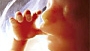 USA: pozew przeciwko szpitalowi za zmuszanie do asystowania przy aborcji