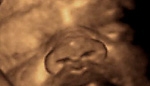 USA: obrońcy życia ostrzegają przed agresywną kampanią środowisk aborcyjnych