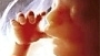 Chcesz być sławna? Przyznaj się do aborcji!!